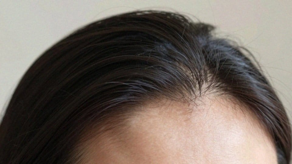 Kiedy pojawiają się pierwsze baby hair po wcierkach?